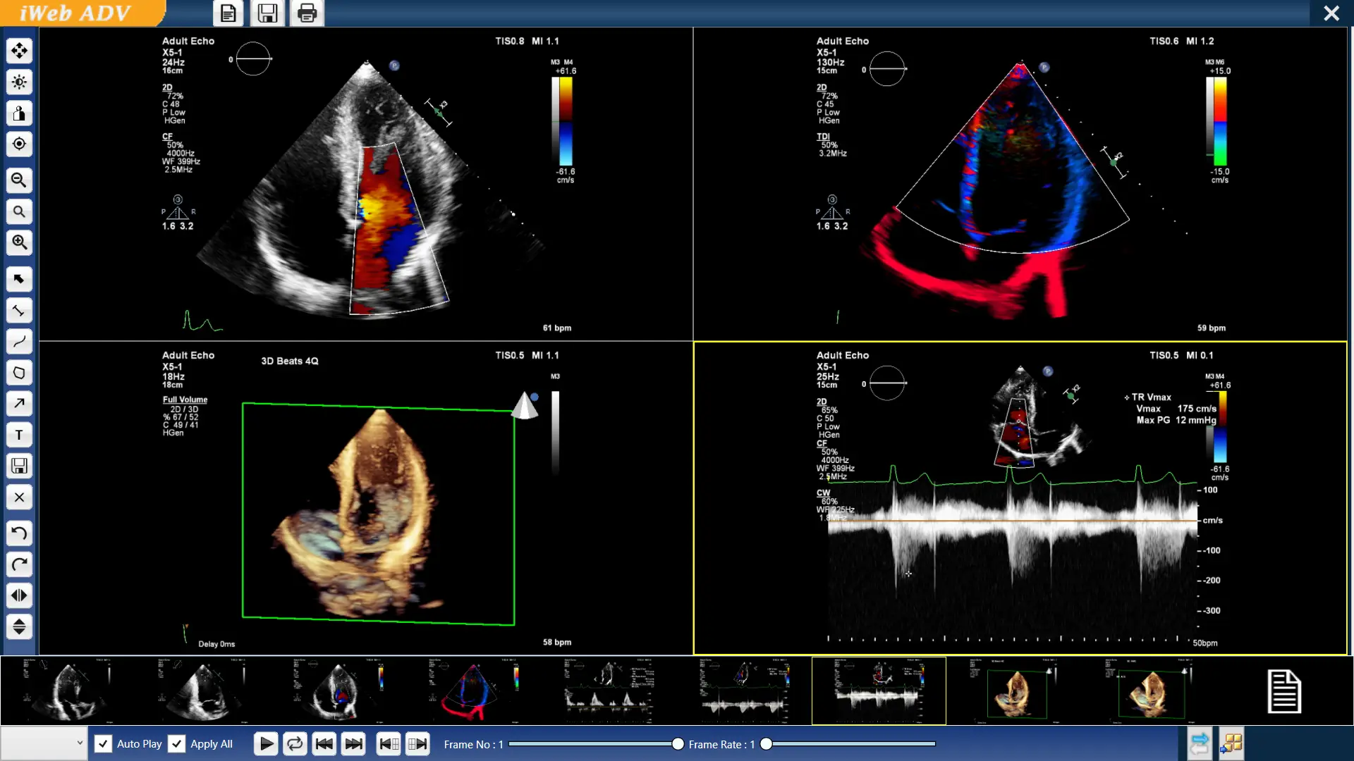 Ultrasound Reporting Software with SR